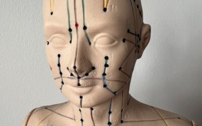 Nadeln für die Augen – Augenakupunktur, was ist das?